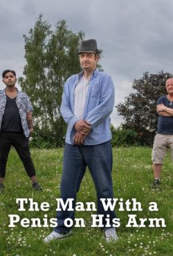 Mężczyzna z penisem na ręce / The Man with a Penis on His Arm